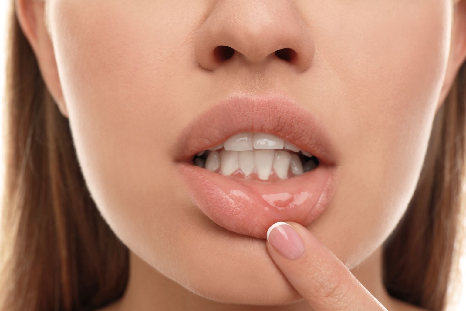 Afte in bocca: come rimediare al dolore